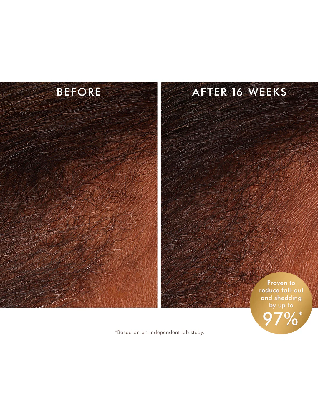 Tonique Revitalisant Cuir Chevelu – Image 2